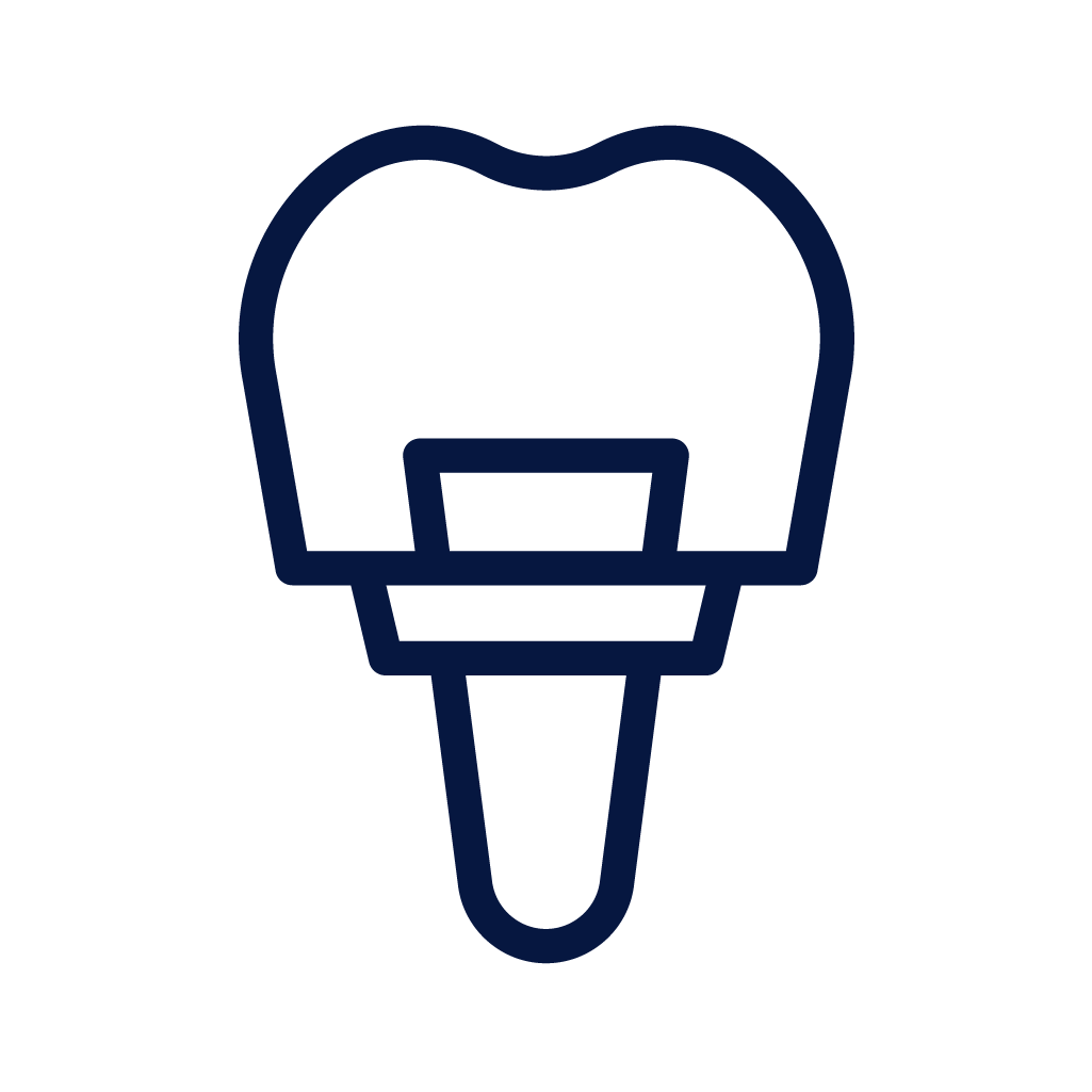 Root Canal Treatment